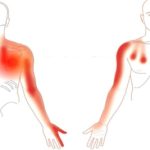Pijn schouder arm hand